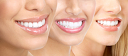 Straightening Teeth with Invisalign Brace