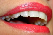 How to Have White Teeth?