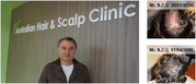 Australian Hair and Scalp Clinic Sydney