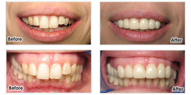 Cosmetic Dentistry Melbourne