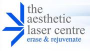 Acne Laser Treatment