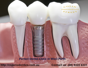 Best-West-perth-Periodontist-in-Australia