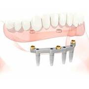 Denture Clinic Essendon	