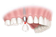 Emergency Dental Health Care Services
