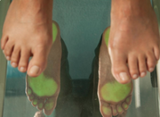 Why Is It Important to visit Orthotic Solutions Podiatry?