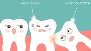 BEDC - Wisdom Teeth