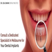 Comfortable Dental Implants By Professional Dentists in Melbourne 