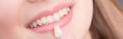 Porcelain Veneers Melbourne | Hawthorn East Dental