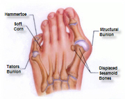 Manly Podiatrist | Podiatrist Manly | Podiatry Services