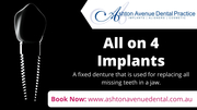 Who can Benefit from All on 4 Dental Implants?