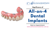 What is the Significance of All-on-4 Dental Implants?