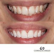 Best cosmetic Dentistry Bella Vista – CompleteSmiles