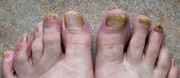 Antifungal Foot Care Fungu New Scientific- https://tinyurl.com/fhtdc8w