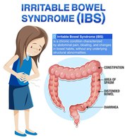 Treat IBS Symptoms Early with BNC