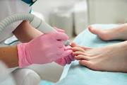 Nail Surgery podiatry Richmond Hill