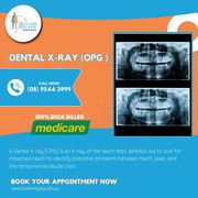 Butler Medical Imaging offers Dental x-ray (opg ).(08) 9544 3999