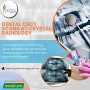 Dental CBCT scan at Crystal Radiology. (02) 8315 8292 