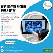 Why Do You Need an OPG X-Ray? at Butler Medical Imaging. (08) 9544 399