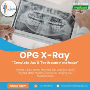 OPG X-Ray: Complete Jaw & Teeth Scan in One Image at Auburn Radiology.