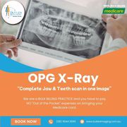 OPG X-Ray: Complete Jaw & Teeth Scan in One Image at Butler Medical Im