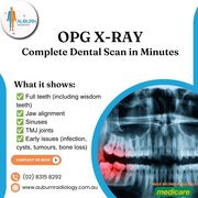 OPG X-RAY: A Complete Dental Scan in Minutes at Auburn Radiology. (02)